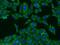 Tax1 Binding Protein 1 antibody, 14424-1-AP, Proteintech Group, Immunofluorescence image 