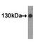 MDS1 And EVI1 Complex Locus antibody, F40200-0.4ML, NSJ Bioreagents, Western Blot image 