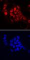 Spliceosome Associated Factor 1, Recruiter Of U4/U6.U5 Tri-SnRNP antibody, MAB8034, R&D Systems, Immunocytochemistry image 