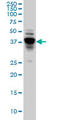 Protein NDRG4 antibody, LS-B6721, Lifespan Biosciences, Western Blot image 