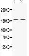 Calcium Sensing Receptor antibody, PB9924, Boster Biological Technology, Western Blot image 