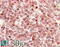 Lysine Methyltransferase 2D antibody, 45-890, ProSci, Immunohistochemistry paraffin image 