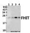 Fragile Histidine Triad Diadenosine Triphosphatase antibody, A01200-1, Boster Biological Technology, Western Blot image 