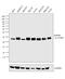 Smith Antigen antibody, MA5-13449, Invitrogen Antibodies, Western Blot image 
