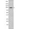 Fibroblast Growth Factor Receptor 3 antibody, PA5-64581, Invitrogen Antibodies, Western Blot image 