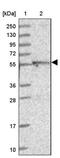 Dihydrouridine Synthase 2 antibody, PA5-60022, Invitrogen Antibodies, Western Blot image 