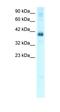 TSC22 Domain Family Member 4 antibody, orb324362, Biorbyt, Western Blot image 