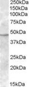 Transmembrane Serine Protease 4 antibody, NBP1-20985, Novus Biologicals, Western Blot image 