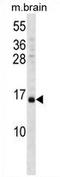 Vesicle Associated Membrane Protein 3 antibody, AP54499PU-N, Origene, Western Blot image 