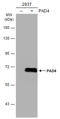 Peptidyl Arginine Deiminase 4 antibody, GTX104659, GeneTex, Western Blot image 