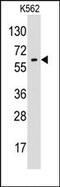 Glypican 6 antibody, AP13462PU-N, Origene, Western Blot image 