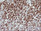 Chromatin Assembly Factor 1 Subunit B antibody, M03959, Boster Biological Technology, Immunohistochemistry paraffin image 