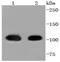 Heat Shock Protein Family H (Hsp110) Member 1 antibody, NBP2-67822, Novus Biologicals, Western Blot image 