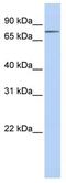 Integrin Subunit Beta 8 antibody, ab80673, Abcam, Western Blot image 