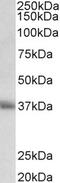 Solute Carrier Family 6 Member 3 antibody, 42-964, ProSci, Western Blot image 