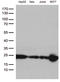 O-6-Methylguanine-DNA Methyltransferase antibody, LS-C794736, Lifespan Biosciences, Western Blot image 