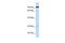 Suv3 Like RNA Helicase antibody, GTX47525, GeneTex, Western Blot image 