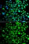 Protein Tyrosine Kinase 6 antibody, GTX33043, GeneTex, Immunofluorescence image 