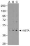V-Set Immunoregulatory Receptor antibody, RF16071, ProSci, Western Blot image 