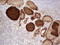 Thyroglobulin antibody, LS-C339075, Lifespan Biosciences, Immunohistochemistry frozen image 