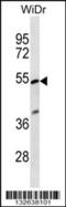 Phosphatidylinositol Glycan Anchor Biosynthesis Class V antibody, 56-789, ProSci, Western Blot image 