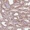 Dishevelled Associated Activator Of Morphogenesis 2 antibody, NBP2-47496, Novus Biologicals, Immunohistochemistry paraffin image 