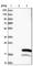 Transmembrane Protein 243 antibody, HPA014918, Atlas Antibodies, Western Blot image 