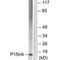 Cyclin Dependent Kinase Inhibitor 2B antibody, PA5-49749, Invitrogen Antibodies, Western Blot image 