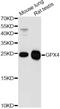 Phospholipid hydroperoxide glutathione peroxidase, mitochondrial antibody, MBS126523, MyBioSource, Western Blot image 