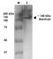 Brevican antibody, NBP2-22401, Novus Biologicals, Western Blot image 