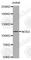 Nucleotide Binding Oligomerization Domain Containing 2 antibody, A1323, ABclonal Technology, Western Blot image 