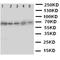 ATP Binding Cassette Subfamily G Member 5 antibody, orb96998, Biorbyt, Western Blot image 