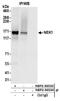 NIMA Related Kinase 1 antibody, NBP2-36533, Novus Biologicals, Immunoprecipitation image 