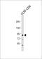 Hdm2 antibody, 56-493, ProSci, Western Blot image 