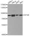 Eukaryotic Translation Initiation Factor 4B antibody, A5405, ABclonal Technology, Western Blot image 