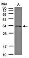 Menin 1 antibody, orb13573, Biorbyt, Western Blot image 