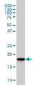 S-Phase Kinase Associated Protein 1 antibody, H00006500-M01, Novus Biologicals, Western Blot image 