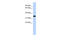 Actin Related Protein T1 antibody, ARP52580_P050, Aviva Systems Biology, Western Blot image 