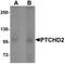 Dispatched RND Transporter Family Member 3 antibody, TA319981, Origene, Western Blot image 