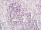 Biorientation Of Chromosomes In Cell Division 1 antibody, GTX51766, GeneTex, Immunohistochemistry paraffin image 