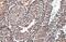 T antibody, GTX131339, GeneTex, Immunohistochemistry paraffin image 