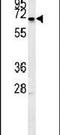 Meis Homeobox 2 antibody, PA5-25432, Invitrogen Antibodies, Western Blot image 