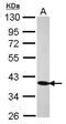Cilia And Flagella Associated Protein 410 antibody, PA5-31331, Invitrogen Antibodies, Western Blot image 