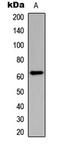 Checkpoint Kinase 2 antibody, LS-C354632, Lifespan Biosciences, Western Blot image 