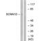 Sodium Channel Epithelial 1 Delta Subunit antibody, A07883-1, Boster Biological Technology, Western Blot image 