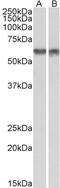 Synaptotagmin 5 antibody, 43-072, ProSci, Western Blot image 