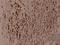 WNK1 antibody, A01422Y52, Boster Biological Technology, Immunohistochemistry paraffin image 