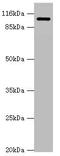 Adaptor Related Protein Complex 2 Subunit Alpha 2 antibody, LS-C675383, Lifespan Biosciences, Western Blot image 