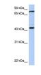 Testis Expressed 9 antibody, NBP1-56553, Novus Biologicals, Western Blot image 