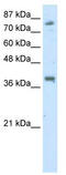 TSC22 Domain Family Member 2 antibody, TA334227, Origene, Western Blot image 